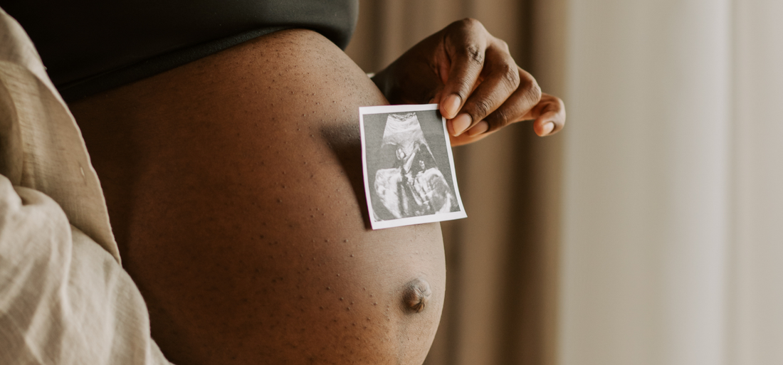 Birth plans – helpful tool or unrealistic pressure?