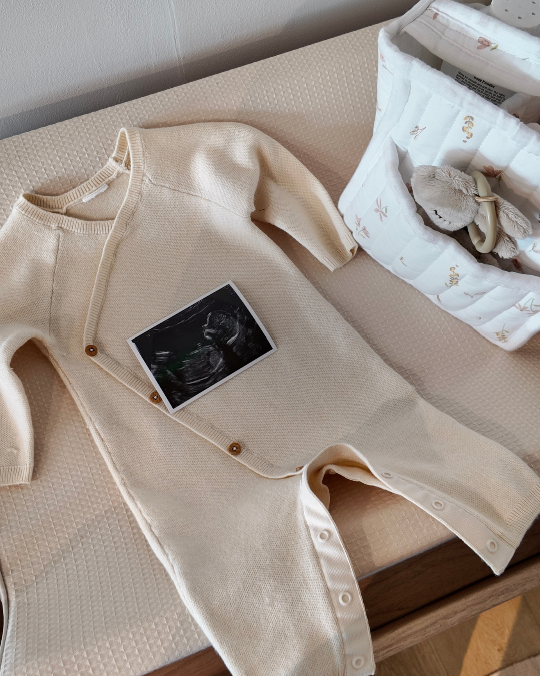 What to Expect at Your First Pregnancy Scan